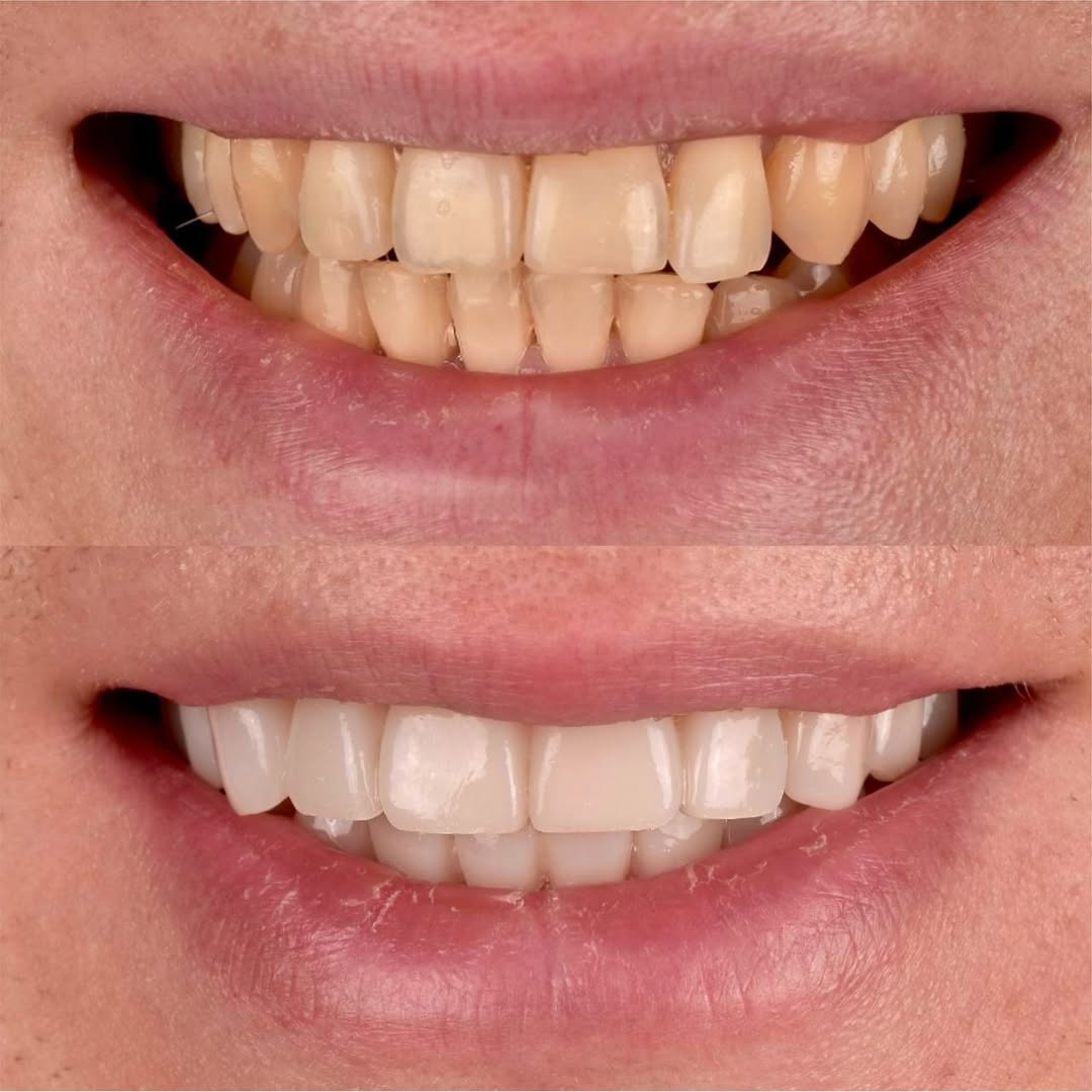 Hollywood Smile Dubai